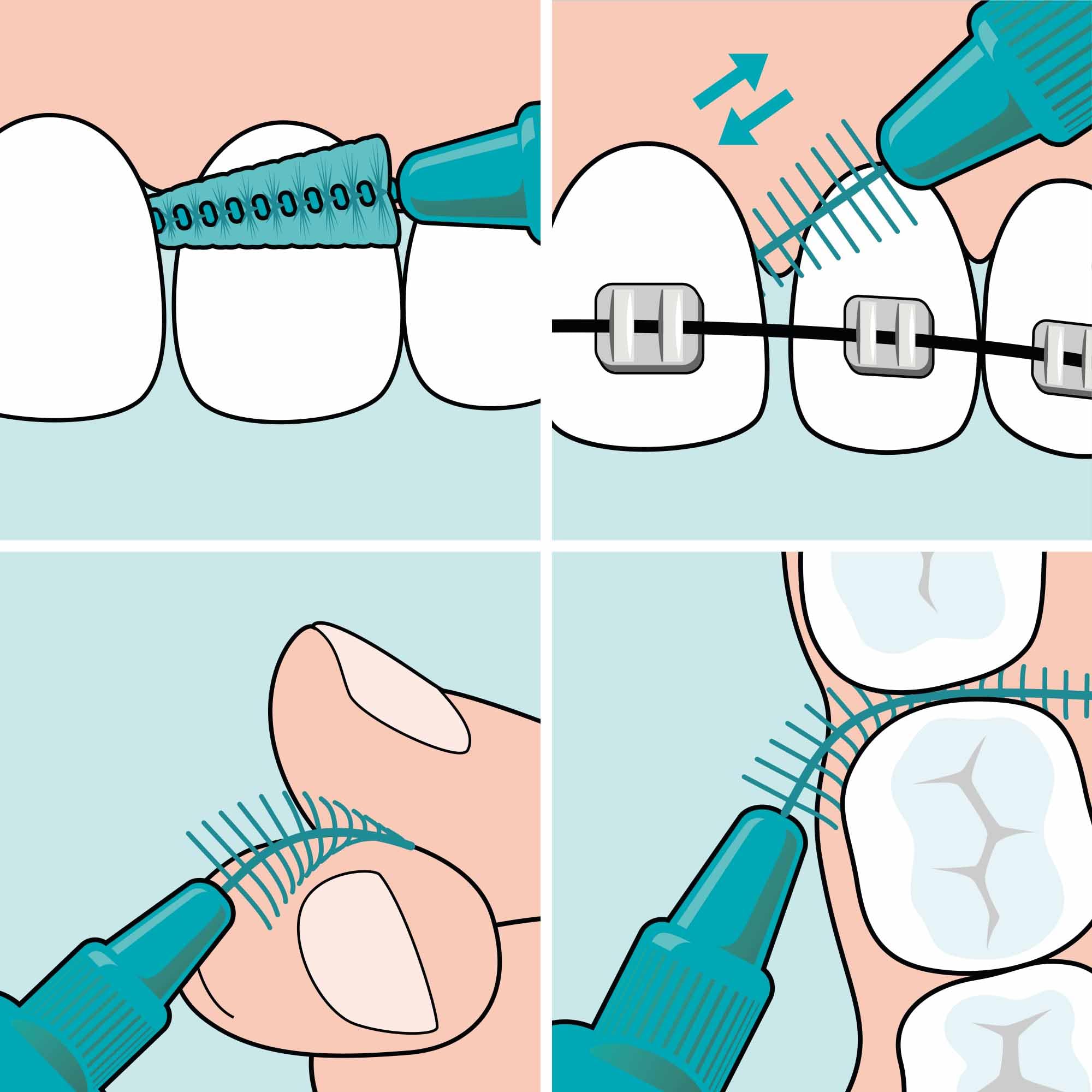 tepe-easyfit-lila-m-l-interdentalb-rste-konisch-6-st-ck image 6