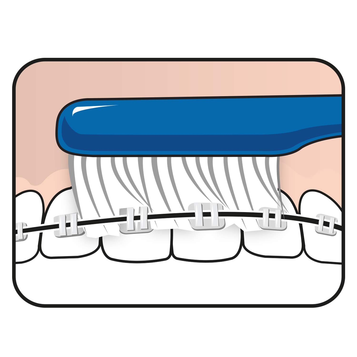tepe-implant-orthodontic-zahnb-rste-3er-pack-extra-schlank-f-r-implantate-und-za image 8