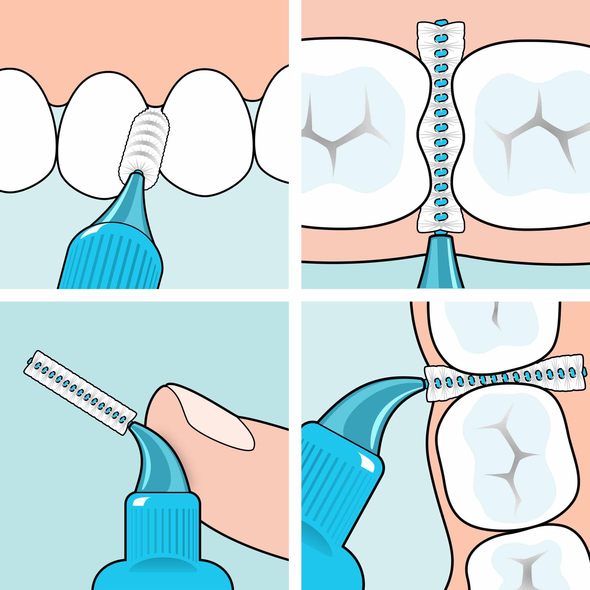 tepe-interdentalb-rste-extra-soft-lila-1-1-mm-iso-6-20-st-ck image 5