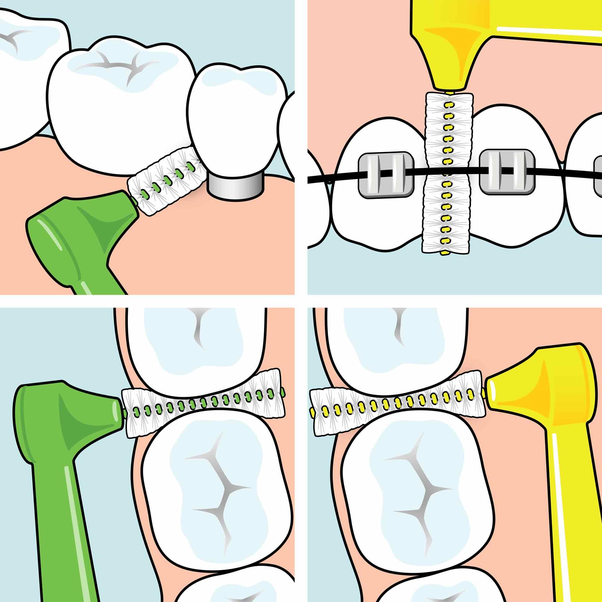tepe-angle-interdentalb-rste-blau-0-6-mm-iso-gr-e-3-6-st-ck image 5