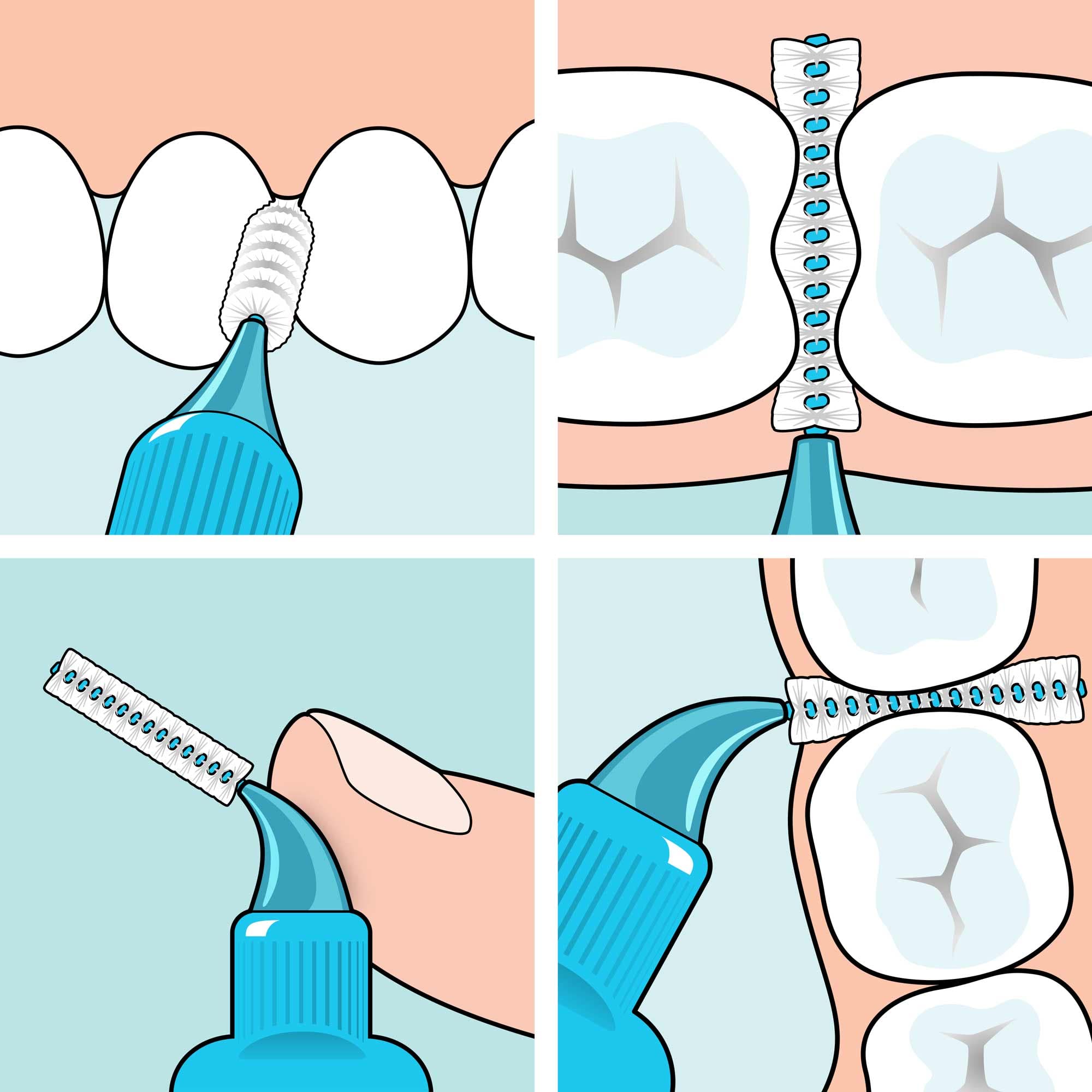 tepe-interdentalb-rste-original-0-7-mm-iso-gr-e-4-gelb-20-st-ck image 5